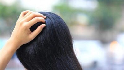 أسباب شائعة لحكّة فروة الرأس