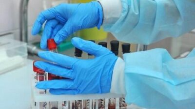 418 حالة نشطة بكورونا في محافظة بعلبك – الهرمل