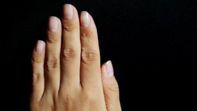 5 علامات في الأظافر تدلّ على نقص في الفيتامينات
