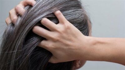كيف يؤثّر التوتر على لون الشعر؟