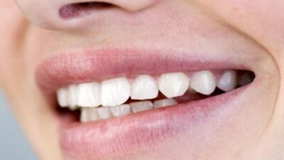 مواد غذائية لا بد منها للأسنان والعظام