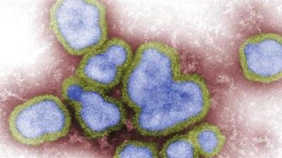 رصد إصابة بشريّة بسلالة إنفلونزا الطيور “H5N6” في الصين