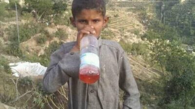 في اليمن .. طفل يتحرك باستنشاق البنزين ويغمى عليه إن نفد !