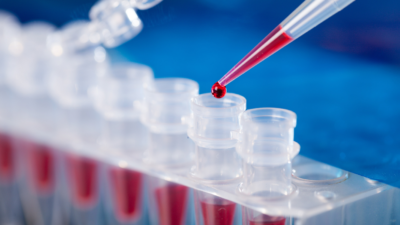 فضيحة عائدات pcr المطار: القضاء يتدخل!