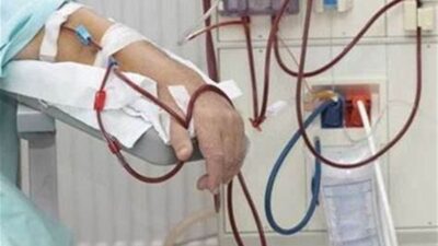 تعاونية موظفي الدولة: تعديل تعرفة جلسة غسل الكلى