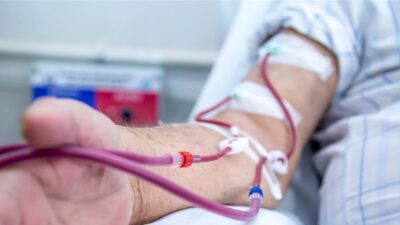 زيادة في تعرفة جلسة غسيل الكلى… كم أصبحت؟