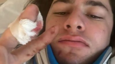 واحد منهم قد لا يمشي مجدداً”… تفاصيل حالة شبّان “فيرمونت” الفلسطينيين
