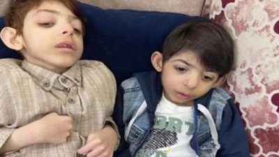سوء التغذية ونقص الدواء.. ساعة واحدة تفصل بين وفاة طفلين شقيقين في غزة