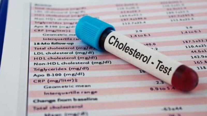 عادات صباحية تساعدك في خفض الكوليسترول فى الدم خلال شهر