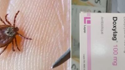 حشرة تتسبب بوفاة فتاة أردنية