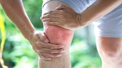 لماذا تسبب عدوى شيكونغونيا آلامًا مفصلية تدوم لسنوات؟